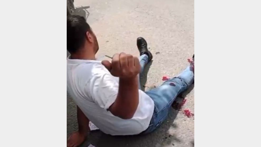 Pütürge'deki Olayda Saldırgan Kadın Tutuklandı