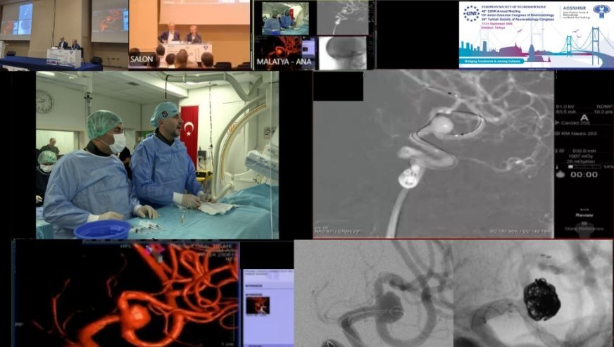 Malatya Ekibi Beyin Ameliyatını Canlı Yayında Yaptı